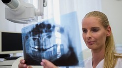 Жители Ивнянского района смогут воспользоваться стоматологическим рентген-аппаратом